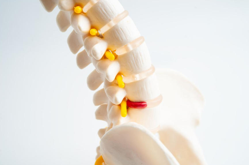 bandscheibenvorfall-natürlich-behandeln-ganzheitliche-therapie-holistische-behandlung-naturheilmittel-hausmittel-massnahmen-naturheilkunde-erfahrungen-gesundheitsindex