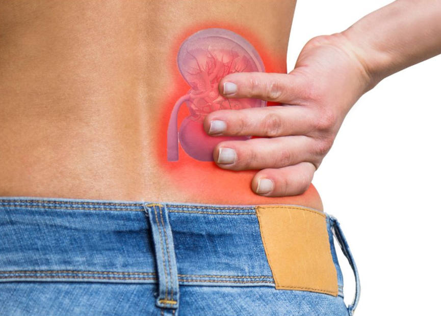 niereninsuffizienz-holisitsche-ursachen-nierenbeschwerden-ganzheitliche-therapie-holistische-behandlung-naturheilmittel-hausmittel-massnahmen-naturheilkunde-erfahrungen-gesundheitsindex