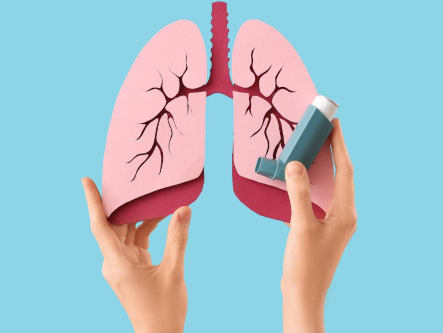 asthma-bronchiale-ganzheitliche-therapie-holistische-behandlung-naturheilmittel-hausmittel-massnahmen-naturheilkunde-erfahrungen-gesundheitsindex-333