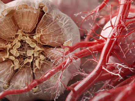 knoblauch-bei-bluthochdruck-gesundheitsindex-333