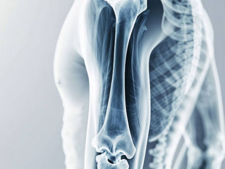 osteoporose-ganzheitliche-therapie-holsitische-behandlung-naturheilmittel-hausmittel-massnahmen-naturheilkunde-erfahrungen-gesundheitsindex-333