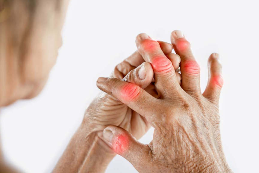 rheuma-rheumatische-beschwerden-ganzheitliche-therapie-holistische-behandlung-naturheilmittel-hausmittel-massnahmen-naturheilkunde-erfahrungen-gesundheitsindex